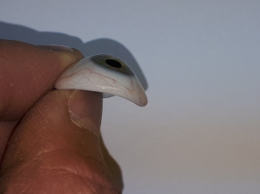 photo-de-prothese-oculaire