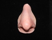 Mediprothèses-épithèse-nasale-d-adolescent