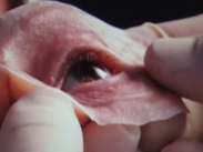 Mediprothèses-maquette-d'épithèse-oculo-palpébrale