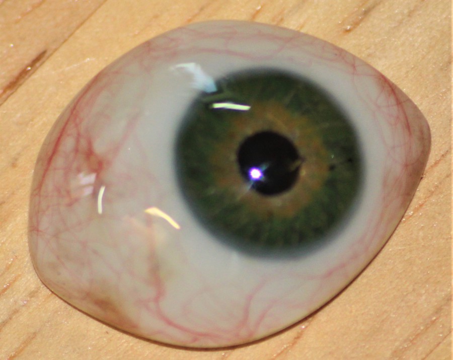 Prothese oculaire enfants adultes, epithese, Montpellier Herault 34